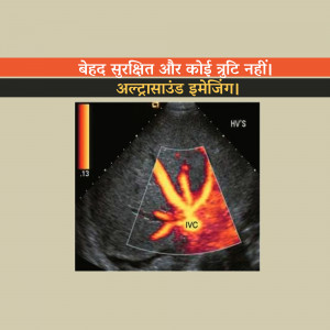 Ultrasound image of a heart with color Doppler showing blood flow
