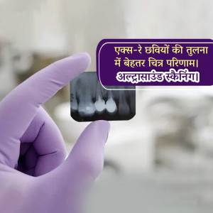 A gloved hand holding up a dental x-ray, with text in Hindi comparing image quality.