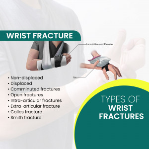 Illustration of a wrist fracture with a person in a sling and details about different fracture types.