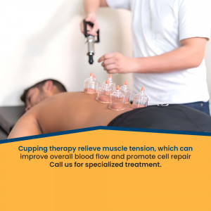 Cupping therapy treatment on a patient's back