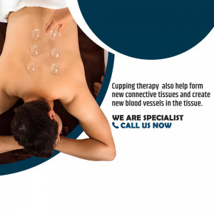 A person receiving cupping therapy on their back.