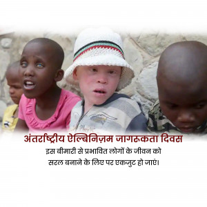 Group of children with albinism, some with visible signs of the condition, with text in Hindi promoting awareness.