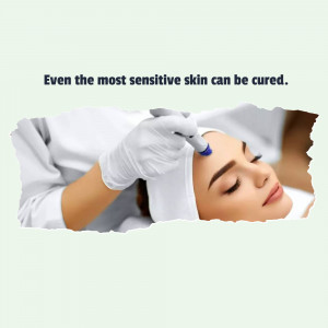 Close-up of a dermatologist treating a woman's skin with a specialized tool.