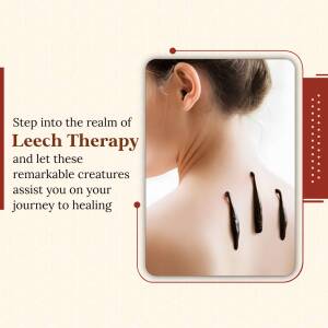Leech Therapy: A Natural Healing Approach Advertisement For Pinterest