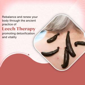 Leech Therapy For Detoxification And Vitality Image For Google Business Profile