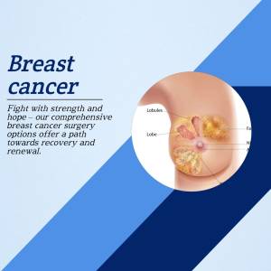 Illustration of breast anatomy with focus on cancer and recovery