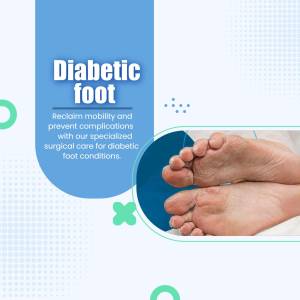 Close-up of feet affected by diabetic foot condition with text overlay promoting specialized care.