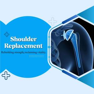 Illustration of a shoulder replacement surgery with a blue and white background.