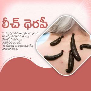 Image depicting leech therapy with leeches on a person's skin and Telugu text.