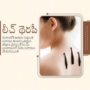 Image depicting leech therapy on a woman's back with Telugu text.