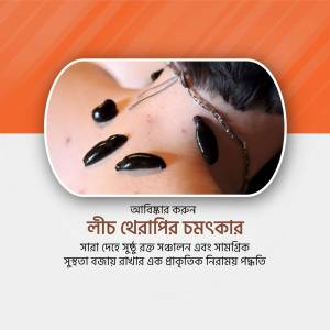 Close-up of leech therapy being performed on a person's skin.