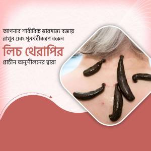 Image depicting leech therapy with leeches on skin, promoting physical recovery and rejuvenation.