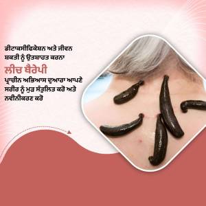 Close-up image of leeches on skin, illustrating leech therapy.