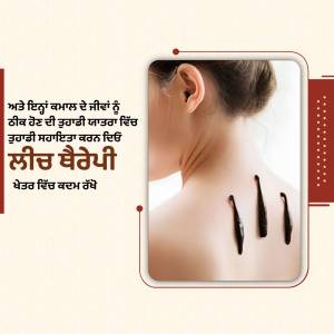 Acupuncture needles inserted in a woman's back for pain relief.