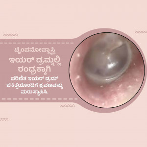 Close-up view of an ear drum during a medical examination.