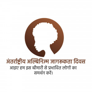 Logo for International Albinism Awareness Day with a silhouette of a person and text in Hindi.