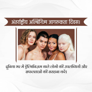Four women with different skin tones, including those with albinism, looking at the camera. Text in Hindi celebrates International Albinism Awareness Day.