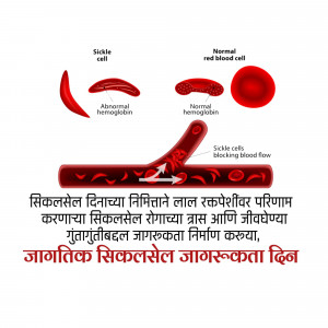 Illustration comparing normal and sickle-shaped red blood cells and their impact on blood flow.
