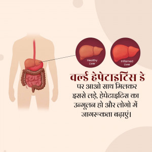 Illustration depicting a healthy and inflamed liver with digestive system, alongside text in Hindi about Hepatitis awareness.