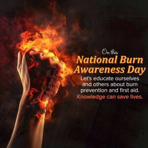 Hand holding a burning object with text 'National Burn Awareness Day'