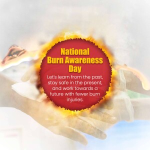 Image promoting National Burn Awareness Day with hands cupping a flame and text about burn prevention.