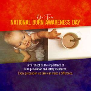 Image promoting National Burn Awareness Day with a baby and a hot beverage.
