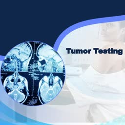 Medical Tumor Testing Imaging Design For X