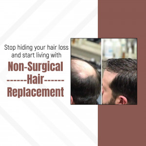 Non-Surgical Hair Replacement Before And After Design For LinkedIn