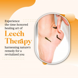 A close up of medicinal leech therapy being applied to a human foot for natural healing