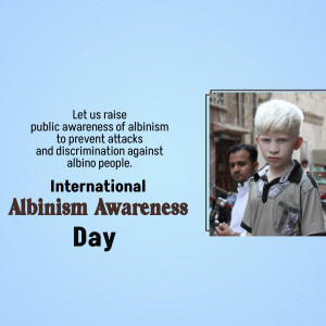 Young boy with albinism for International Albinism Awareness Day campaign